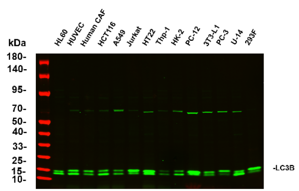 Recombinant LC3B Monoclonal Antibody (AN301035L)