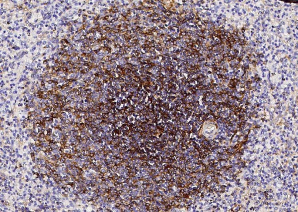 Recombinant CD73/NT5E Monoclonal Antibody (AN300353P)