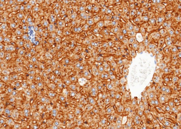 Recombinant ASGPR1/ASGR1 Monoclonal Antibody (AN300469P)