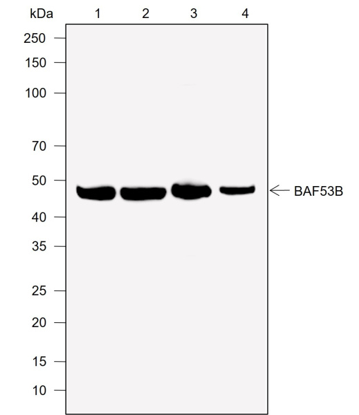 Recombinant BAF53B Monoclonal Antibody (AN302040L)