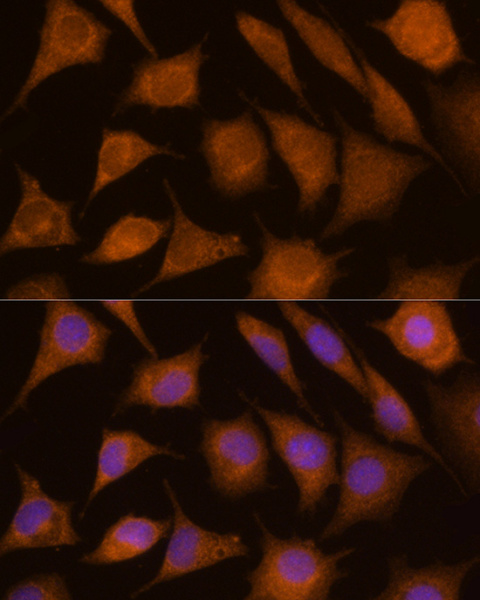 CTSC Polyclonal Antibody (E-AB-68422)