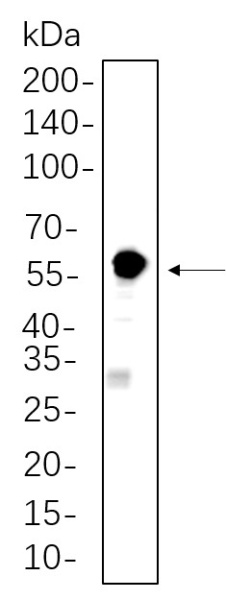 Recombinant SESN2 Monoclonal Antibody (AN300788L)