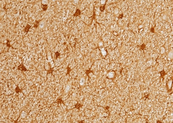 Peroxiredoxin 6/PRDX6 Monoclonal Antibody (AN200048P)