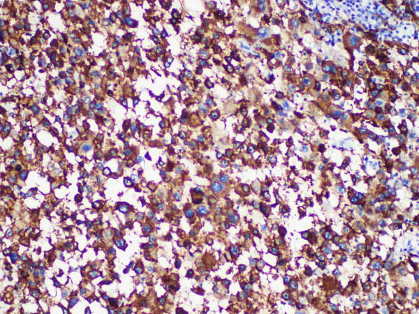 HMB-45 Monoclonal Antibody (ELAB6942-M)