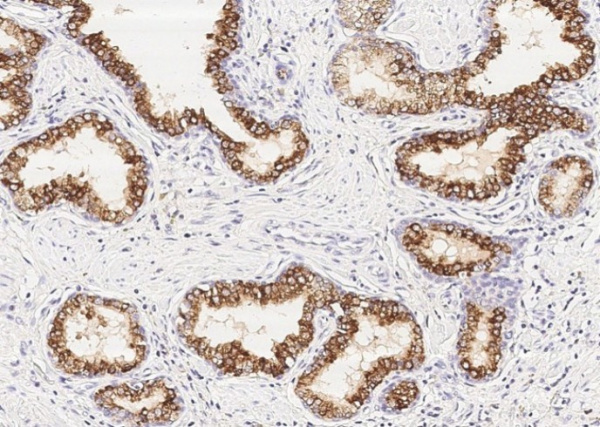 ENTPD5 Monoclonal Antibody (AN200117P)
