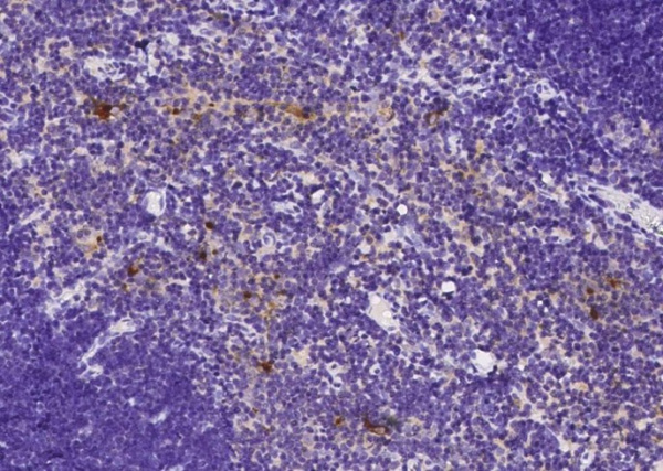 Recombinant B2M/beta-2 microglobulin Monoclonal Antibody (AN300591P)