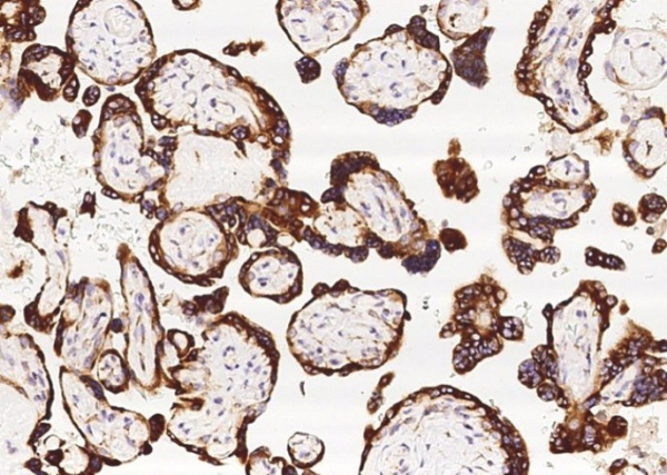 TNFAIP8 Monoclonal Antibody (AN200068P)