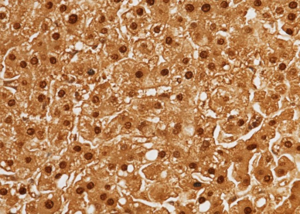 Recombinant ARG1/Arginase 1 Monoclonal Antibody (AN300403P)