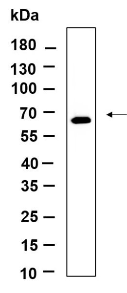 Recombinant Phospho-PERK (Thr980) Monoclonal Antibody (AN301388L)