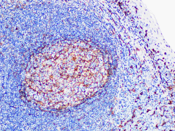 CD14 Monoclonal Antibody (ELAB6145-M)