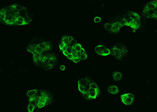 Recombinant CD73/NT5E Monoclonal Antibody (AN300354P)