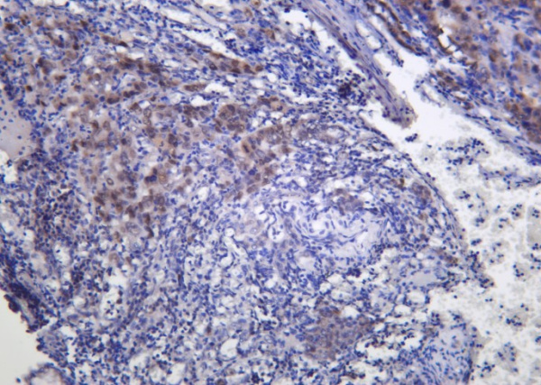 Recombinant FRA1 Monoclonal Antibody (AN301247L)