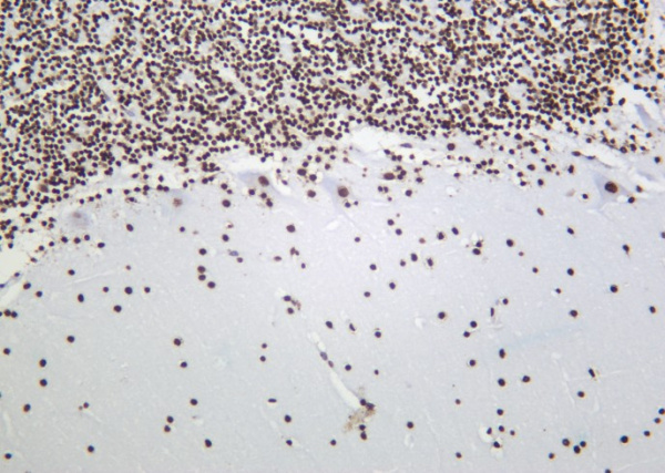 Recombinant Histone H3 (Tri Methyl Lys9) Monoclonal Antibody (AN301154L)