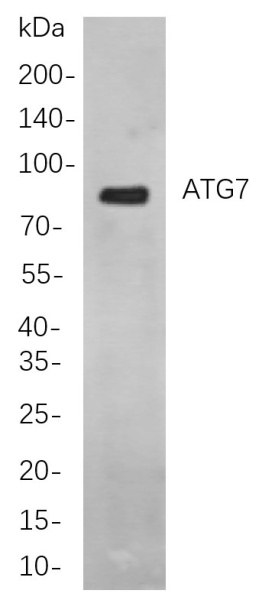 Recombinant ATG7 Monoclonal Antibody (AN300970L)