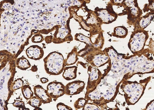 Recombinant PNP Monoclonal Antibody (AN300414P)