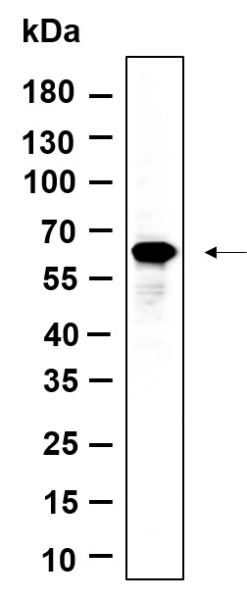 Recombinant FoxO4 Monoclonal Antibody (AN301142L)