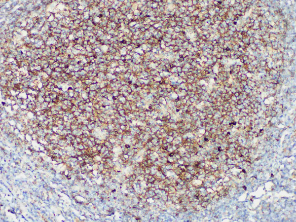 IgM Monoclonal Antibody (ELAB6833-R)