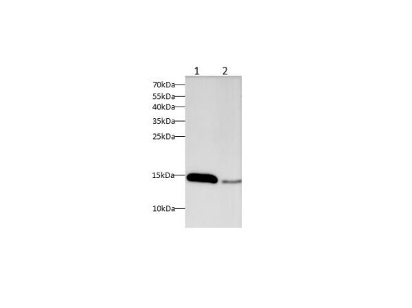 IFABP Polyclonal Antibody (D-AB-10381L)