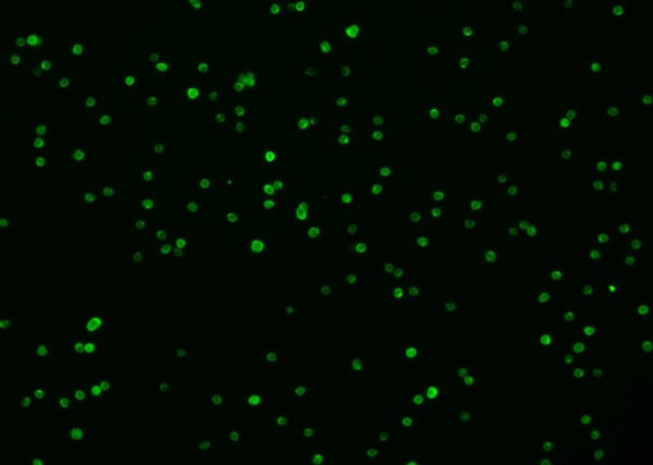 Recombinant Syndecan-4/SDC4 Monoclonal Antibody (AN300551P)