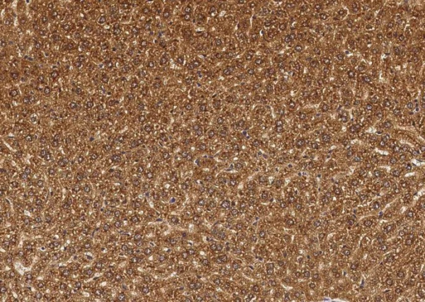 Recombinant Cathepsin B/CTSB Monoclonal Antibody (AN300470P)