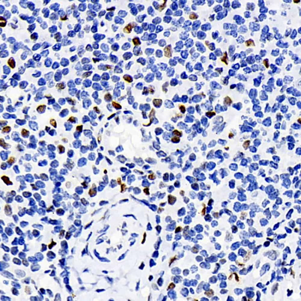 ERK 2 Polyclonal Antibody (E-AB-70241)