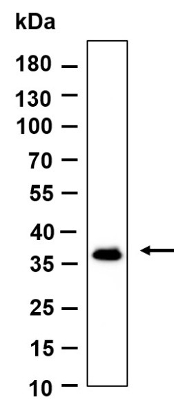 Recombinant OXGR1 Monoclonal Antibody (AN301217L)
