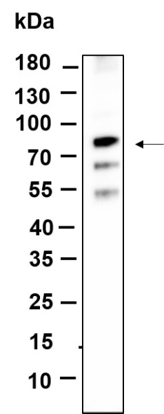 Recombinant NGFR p75 Monoclonal Antibody (AN301175L)