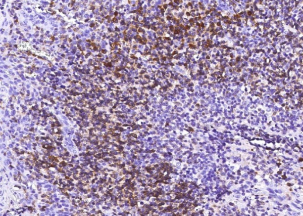 Recombinant CD79A/Ig-alpha Monoclonal Antibody (AN300138P)