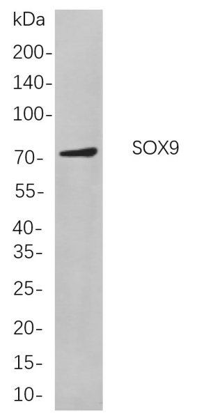 Recombinant SOX9 Monoclonal Antibody (AN301042L)