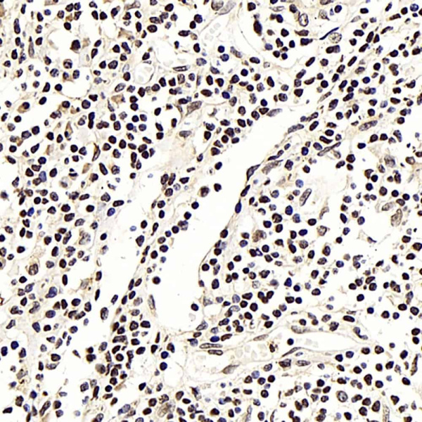 NFKBIB Polyclonal Antibody (E-AB-70167)