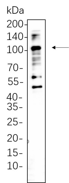 Recombinant CD68 Monoclonal Antibody (AN301356L)