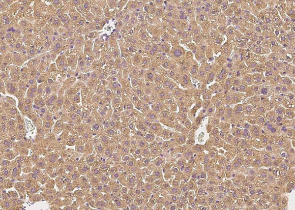 Recombinant Complement Factor H Monoclonal Antibody (AN300573P)