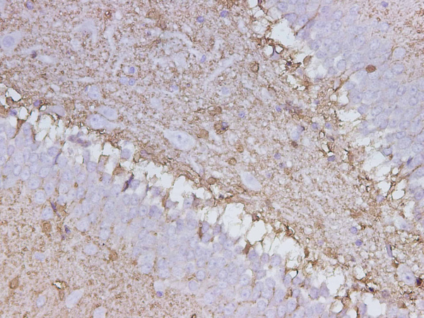 S100B Polyclonal Antibody (D-AB-10235L)