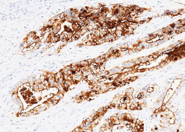 Recombinant Phospho-EGF Receptor (Tyr845) Monoclonal Antibody (AN300375L)