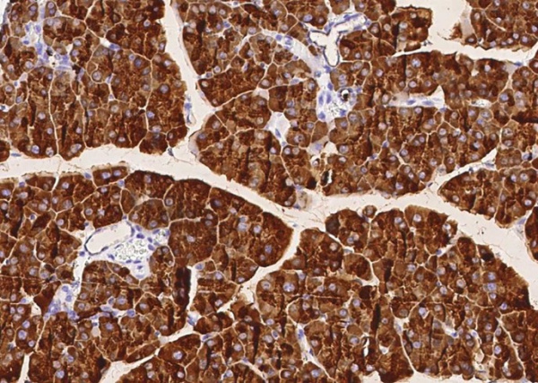 Recombinant Bile salt-activated lipase/CEL Monoclonal Antibody (AN300536P)