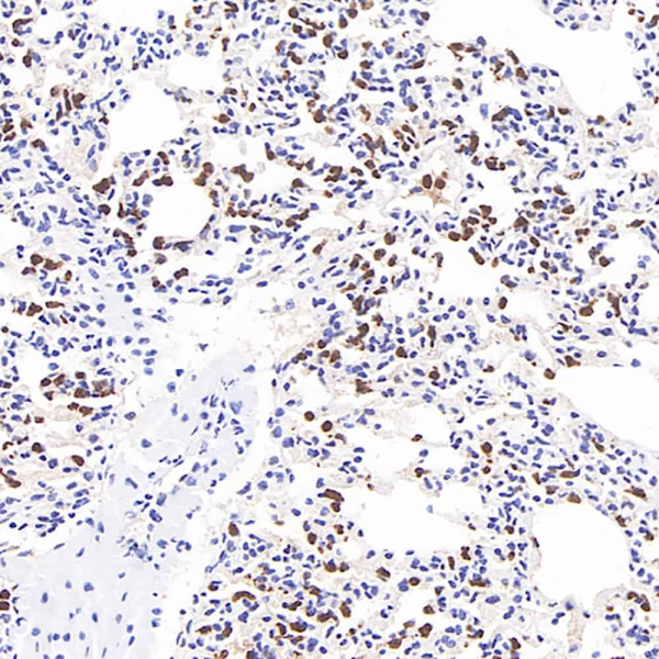MMP9 Monoclonal Antibody (E-AB-70246)