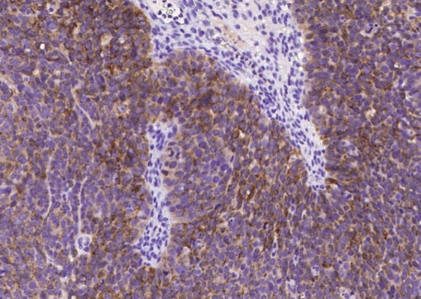 Mesothelin/MSLN Monoclonal Antibody (AN200134P)