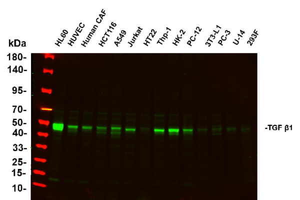 Recombinant TGF β1 Monoclonal Antibody (AN300941L)