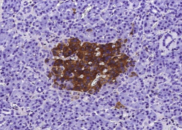 Recombinant IGFBP7 Monoclonal Antibody (AN300065P)