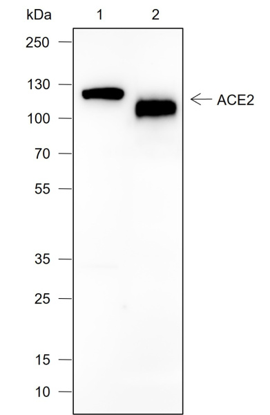 Recombinant ACE2 Monoclonal Antibody (AN301988L)