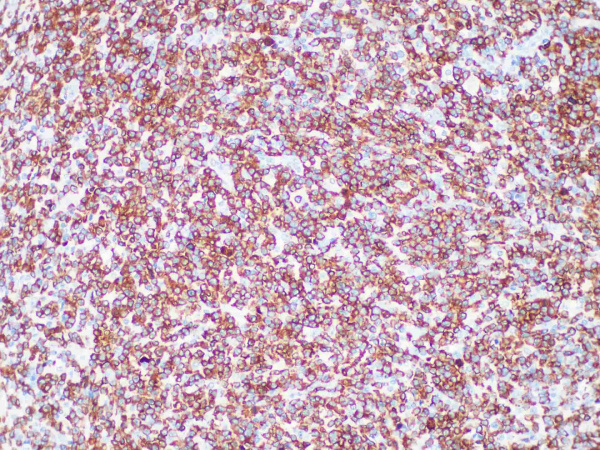 ALK Monoclonal Antibody (ELAB6910-R)