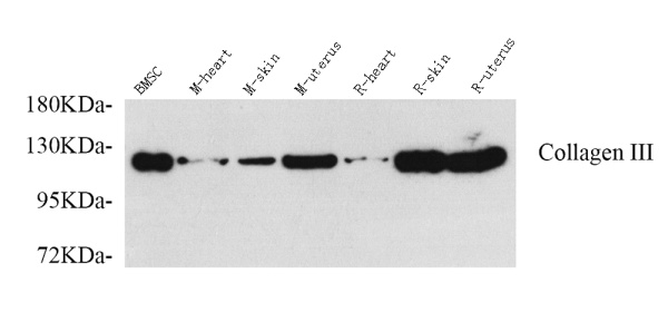 COL3A1 Polyclonal Antibody (E-AB-70009)