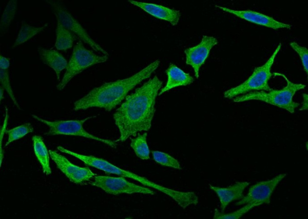 Recombinant Vimentin Monoclonal Antibody (AN300104P)