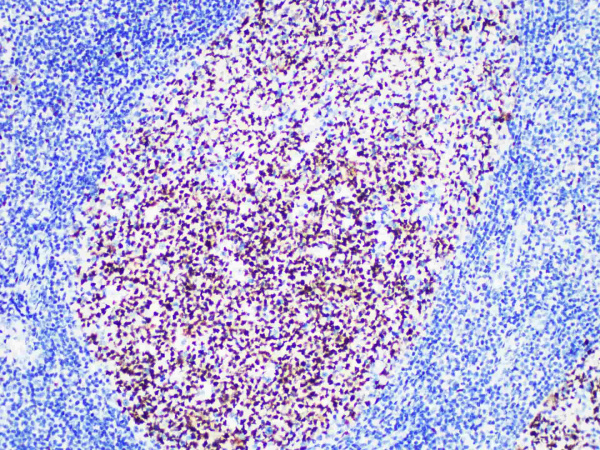 BCL6 Monoclonal Antibody (ELAB6902-R)
