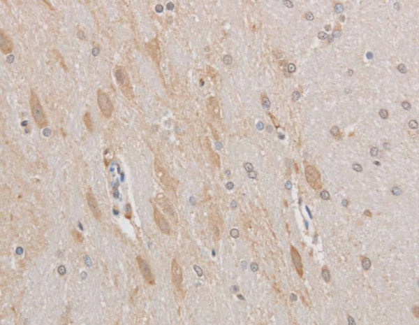 MAP2 Polyclonal Antibody (E-AB-40166)