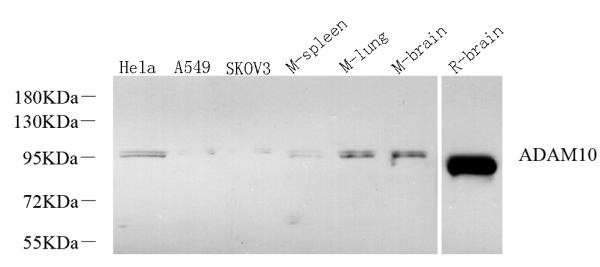 CD156c Polyclonal Antibody (E-AB-70180)