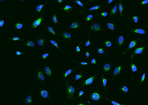 Recombinant IGFBP7 Monoclonal Antibody (AN300063P)