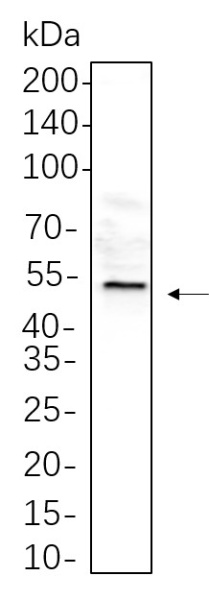 Recombinant Desmin Monoclonal Antibody (AN301317L)