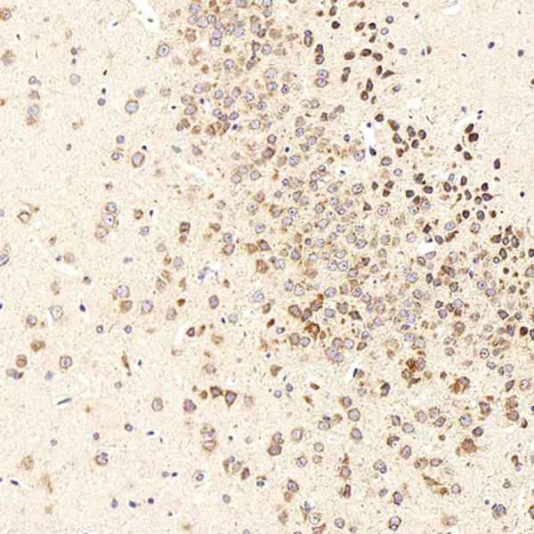beta Amyloid Polyclonal Antibody (E-AB-70168)