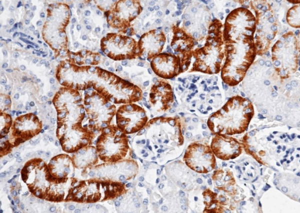Recombinant SLC3A2/CD98 Monoclonal Antibody (AN300562P)